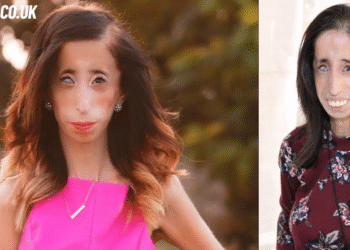 lizzie velasquez